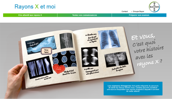 Bayer lance la campagne « les rayons X et moi »
